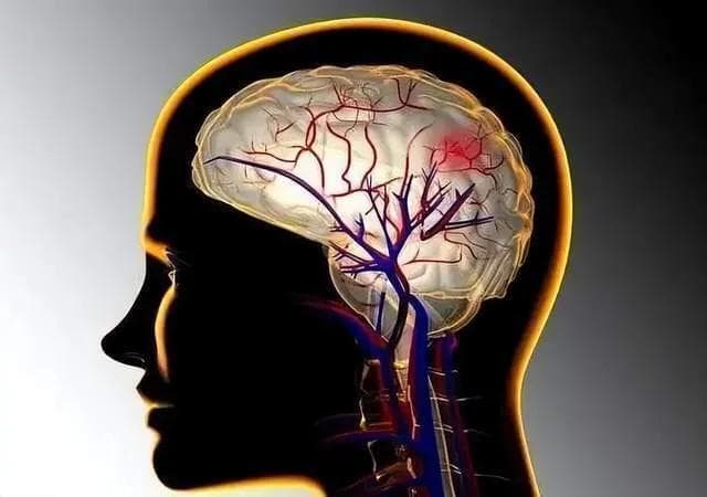 什么是脑供血不足？医生提示：调整7种生活方式，保护血管健康
