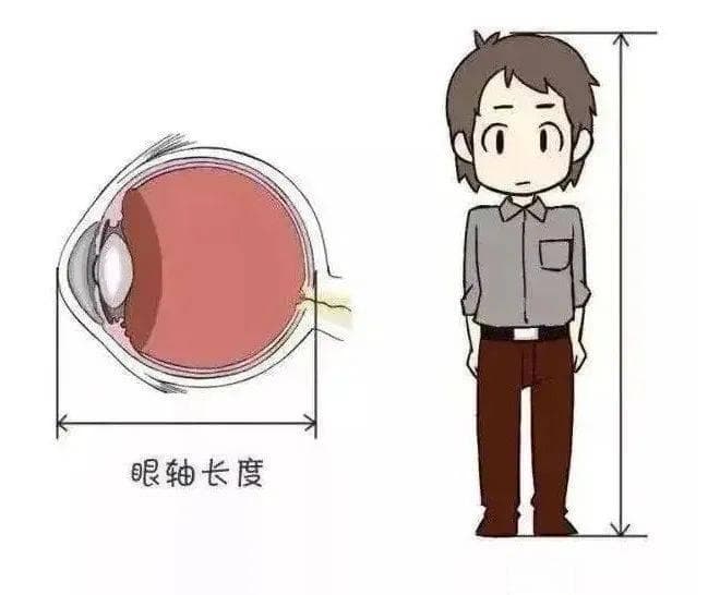 为什么要定期测眼轴？近视与眼轴生长密切相关！