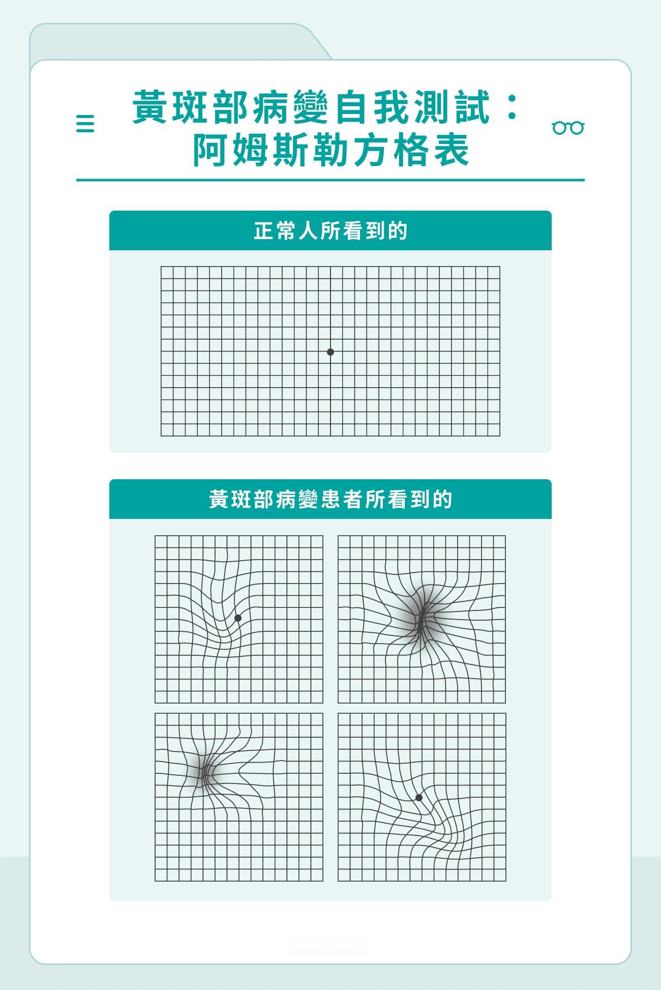 黄斑部病变症状有哪些？1图初步辨识+2类病变成因+3招治疗分享