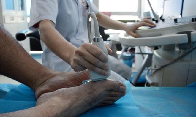 痛风治疗药物使用全攻略：非布司他、别嘌醇、苯溴马隆和秋水仙碱