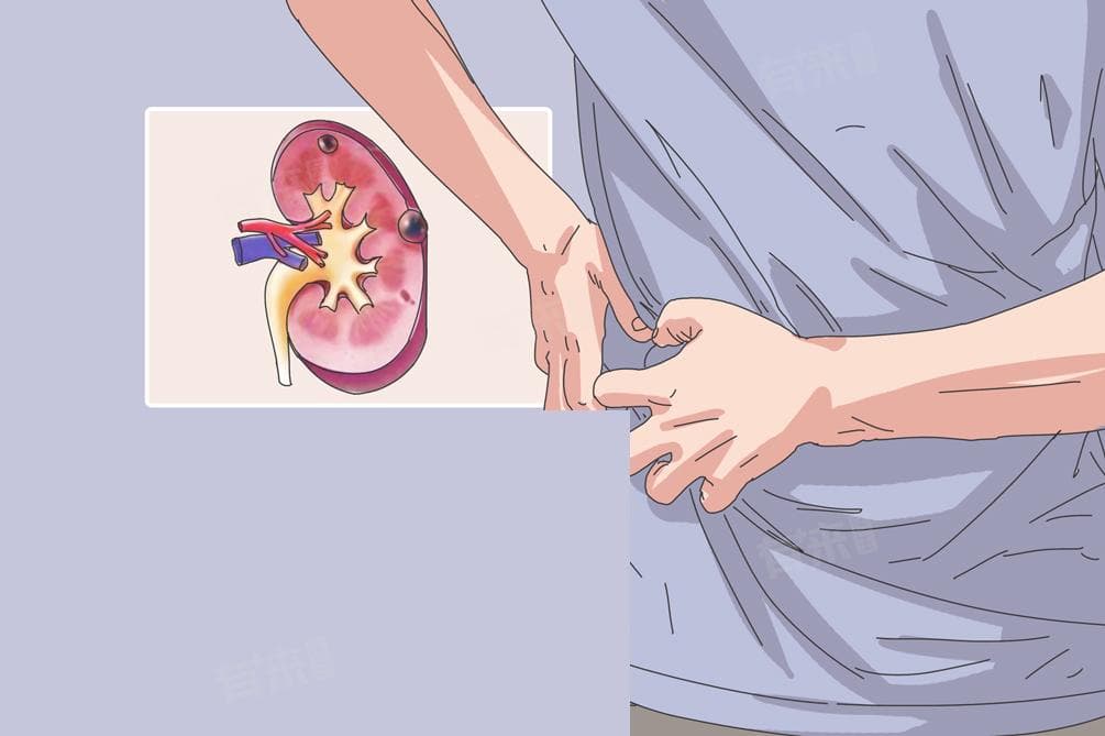 肾囊肿可以自行消失吗