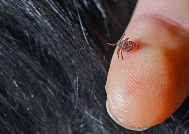 蜱虫叮咬可致莱姆病，专家教你正确应对