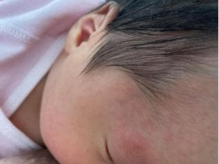 春光正好，别被皮肤过敏“撂倒”！这份脱敏指南请收好