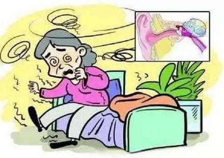 搅动天地的小石头——耳石症