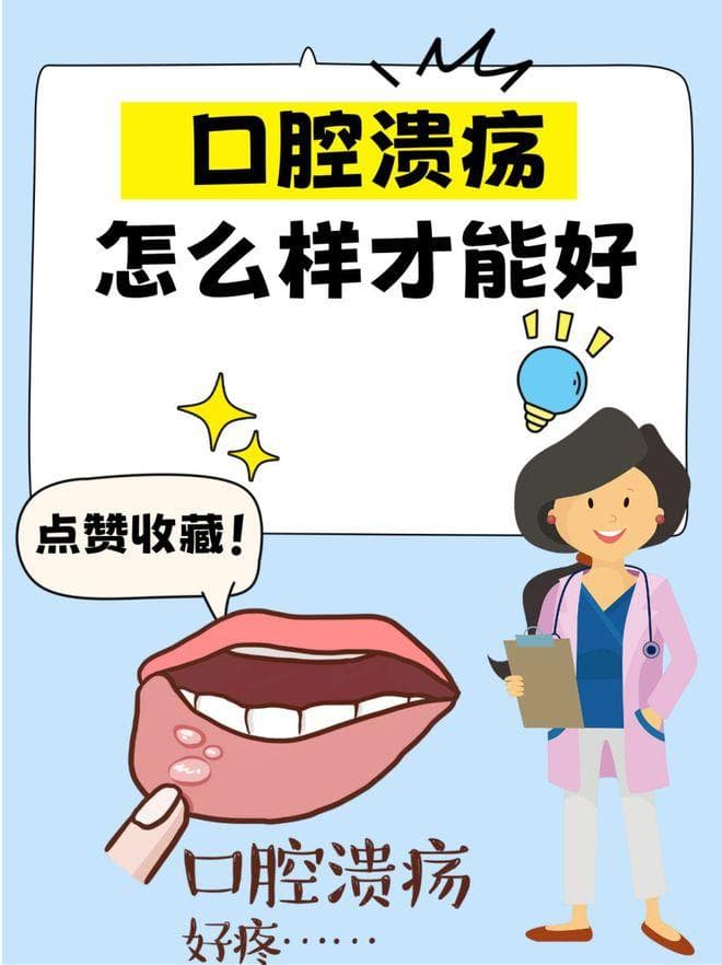 口腔溃疡的治疗方法和预防措施