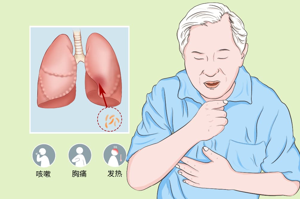非结核分枝杆菌病