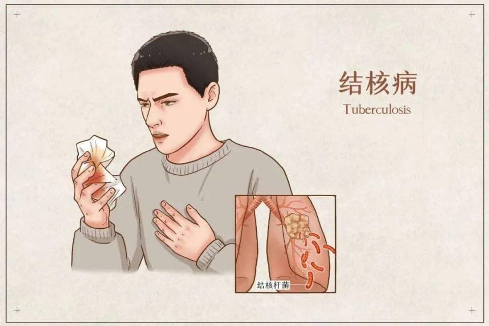 世界防治结核病日：全面解读与预防肺结核！向肺结核说不！