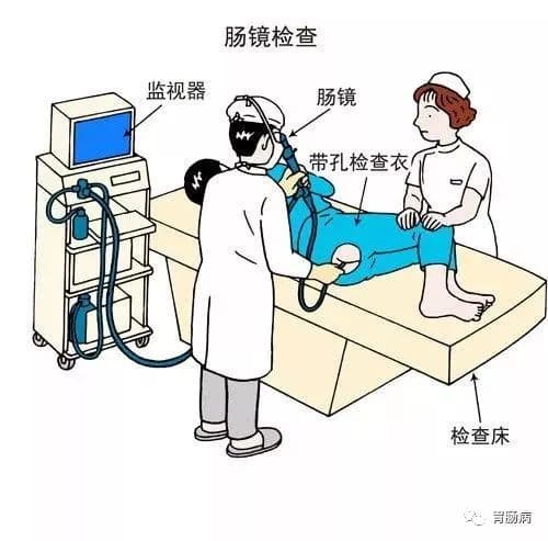 肠镜检查前如何清肠，请收下这份最详细的指南
