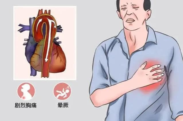 热҈热҈热҈！炎炎夏日，心衰患者如何科学饮水？