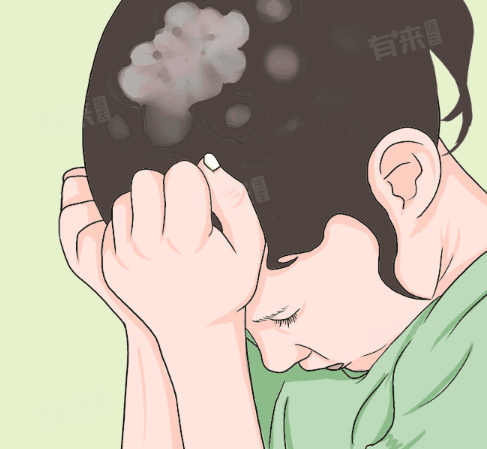 小孩头上长癣状白皮屑是怎么回事，怎么办
