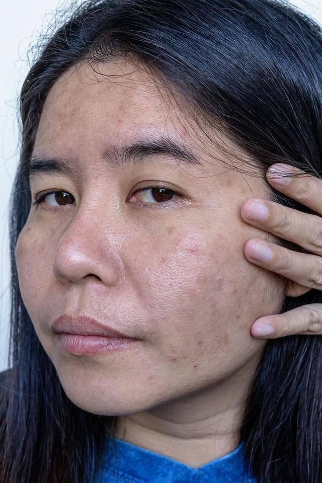 “菜色脸”到底是如何形成的呢？又该如何改善这种问题呢？