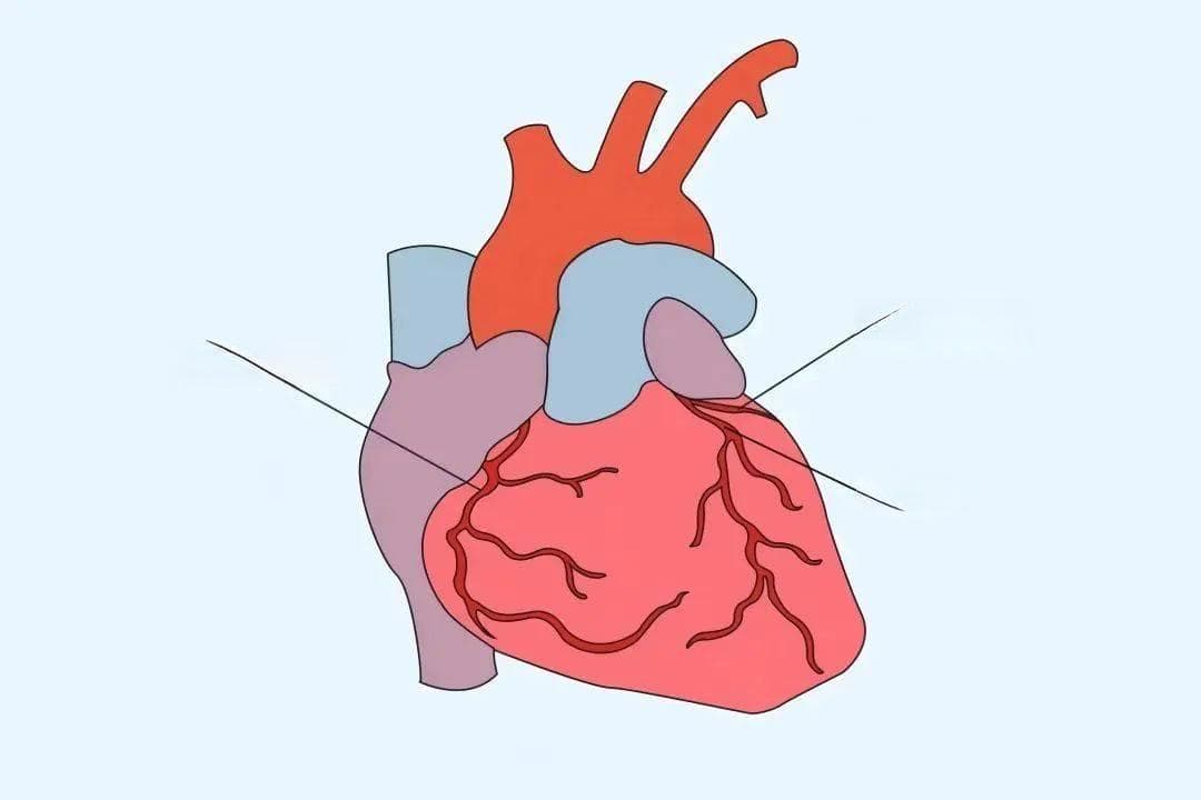 冠状动脉CTA：心脏健康的“透视眼”