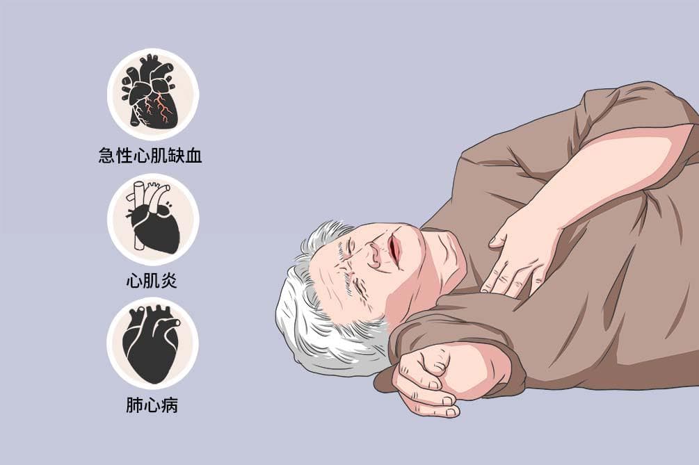 人在猝死前,身体可能会发出几个信号,及时发现或能获救