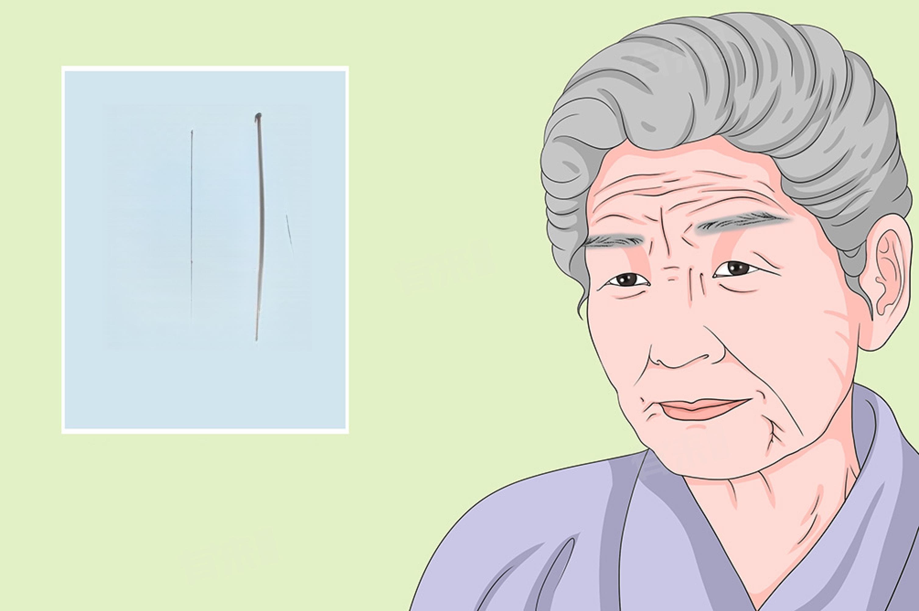 眼睛出现重影怎么治疗