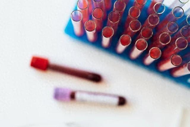 低密度脂蛋白从5.3降到1.8，其实并不难，做好这4点就够了