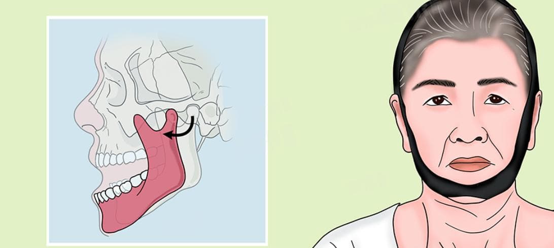 下巴脱臼挂号挂什么科