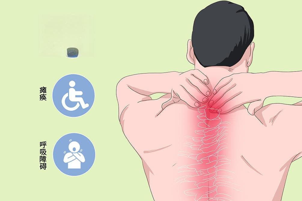 脊髓损伤评定标准详解：从A级到E级的临床表现