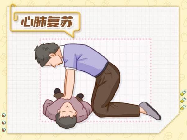 揭秘冠心病：从认识到预防，守护你的心脏健康
