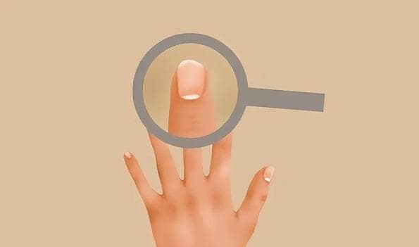 指甲盖上有竖纹是咋回事？真是老人说的“肝脏不好”吗？提前了解