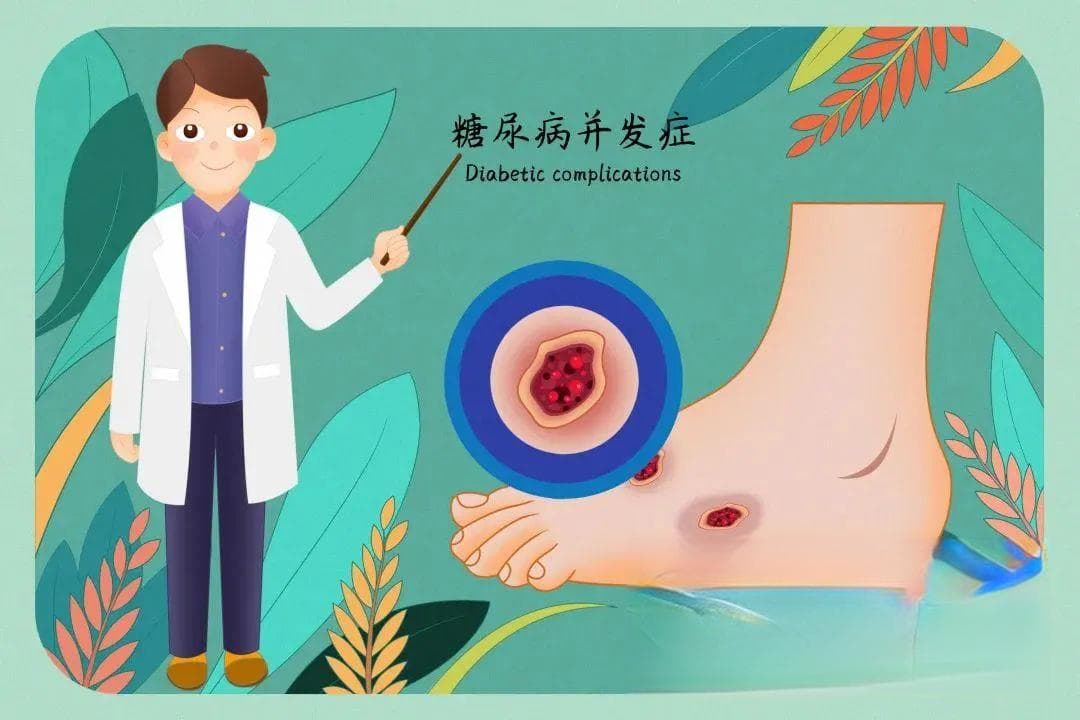 远离糖尿病足，要这样做→