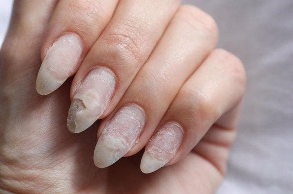宝宝趴睡脸上有湿疹怎么办？专家解析原因及护理要点