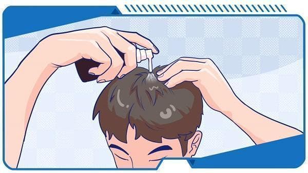 生发神器？狂脱期？关于米诺地尔的真相都在这里！