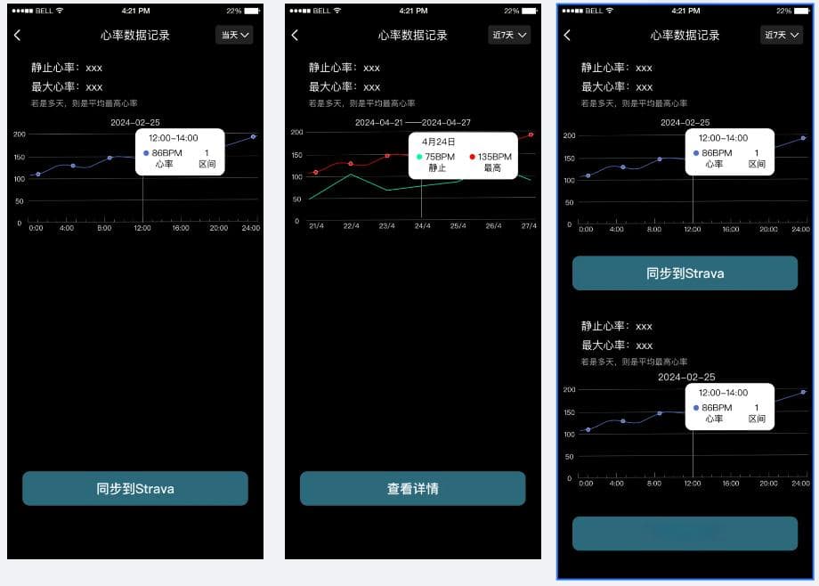 传感器+AI：智能穿戴设备引领健康监测新革命