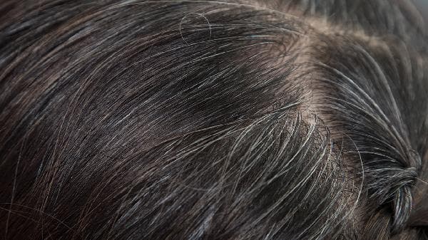 白头发增多怎么办？原因分析与应对方案