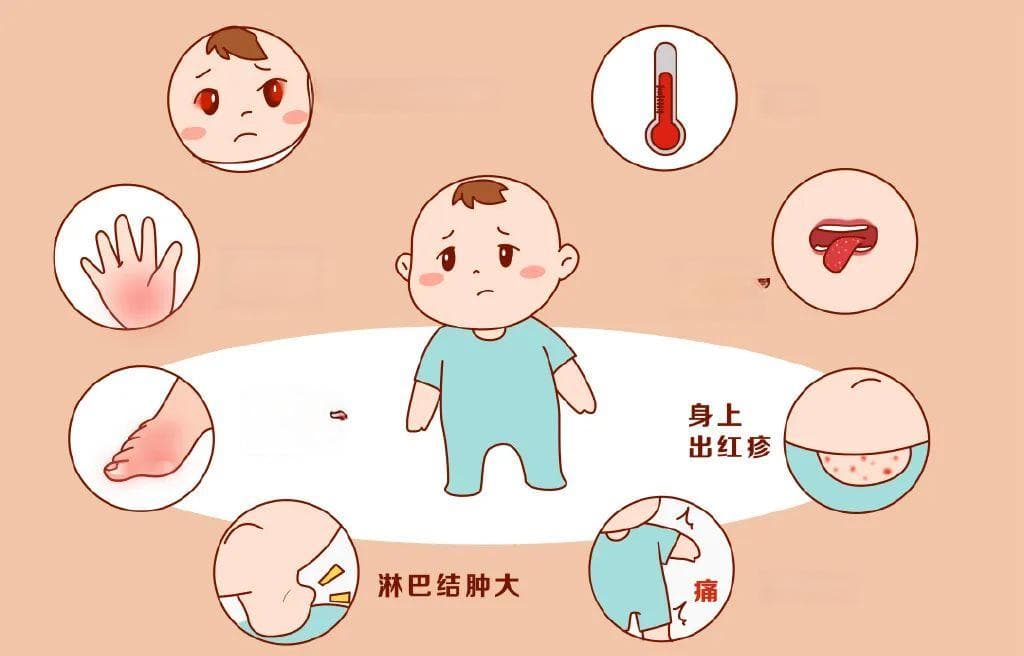 “坏心的”川崎病 | 贤医健康说