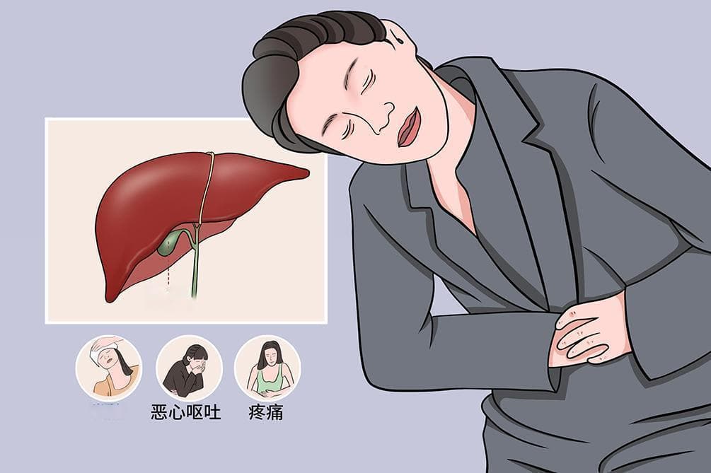 胆囊炎自我恢复办法