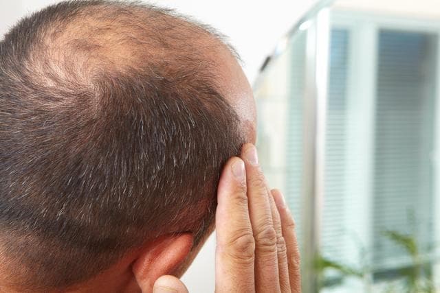 头皮上总摸到“小疙瘩”，是啥东西？对健康有何影响？告诉你真相