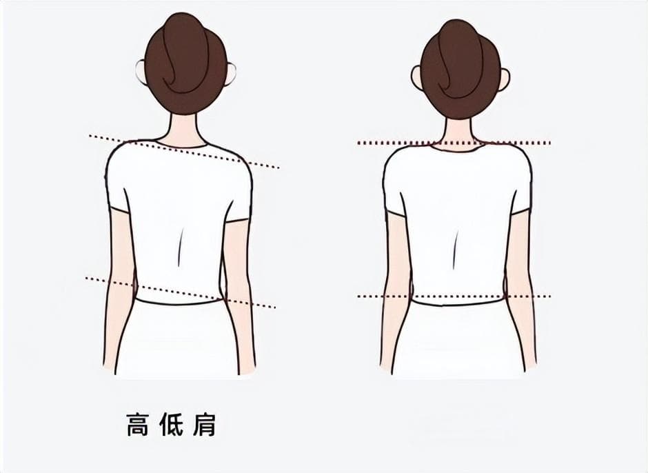 背包时老掉肩带，可能你有“高低肩”