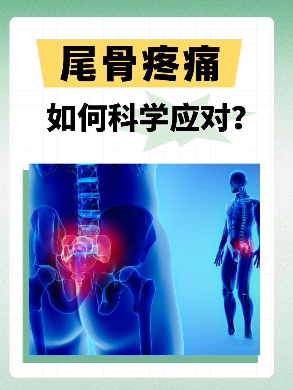 尾骨疼痛，如何科学应对？