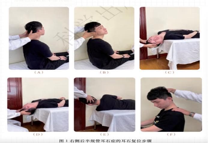 耳石症治疗迎来突破：专家详解病因与最新疗法