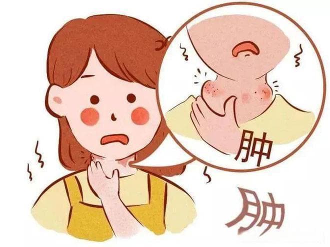 嗓子痛、喉咙肿怎么办？教你几招快速缓解