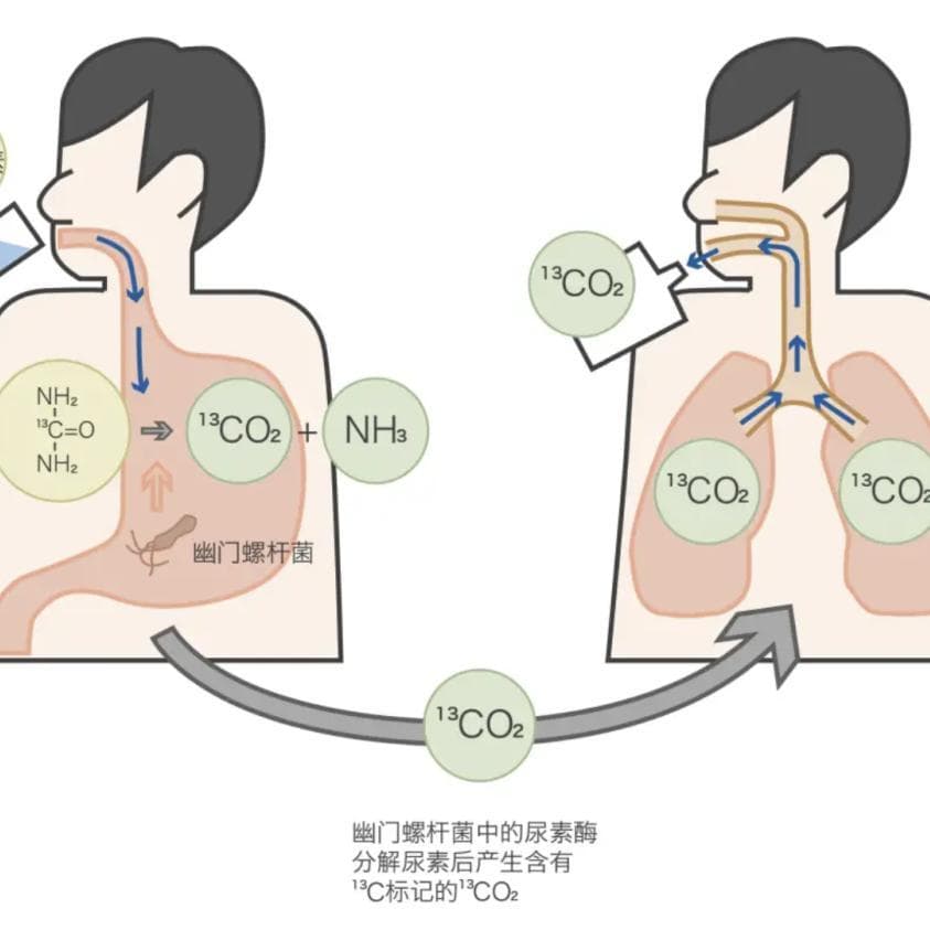 萎缩的不是胃口，而是胃