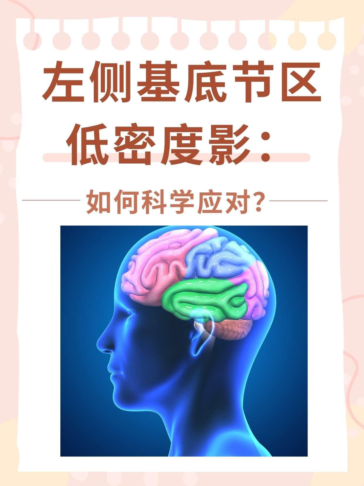 左侧基底节区低密度影：如何科学应对？