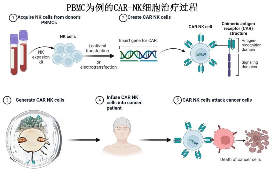 CAR-NK细胞免疫疗法简述