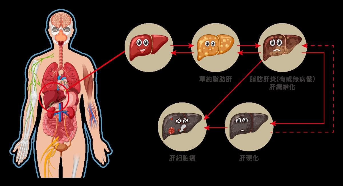 10大保肝食物：从咖啡到十字花科蔬菜的科学指南