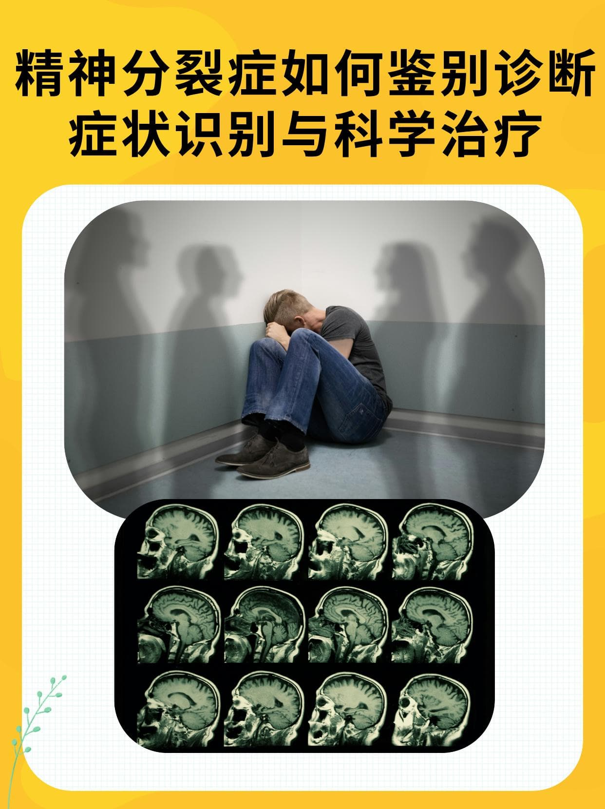 精神分裂症如何鉴别诊断？症状识别与科学治疗