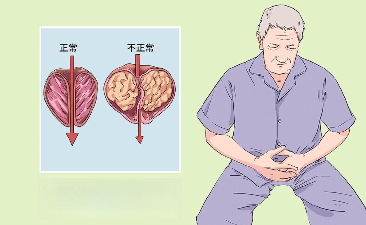 如何预防尿路感染？尿路感染预防指南