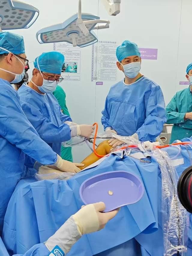 湾区落地关节软骨损失新技术