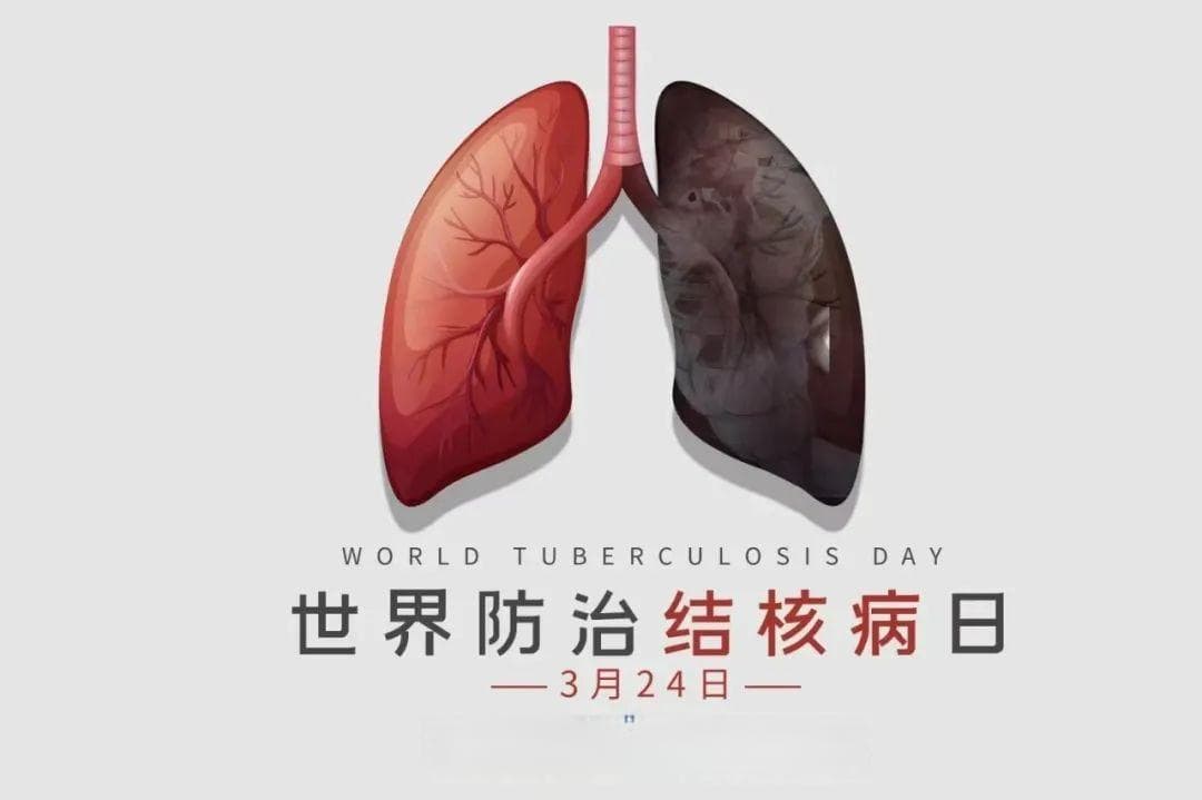 当“肺结核”遇上“糖尿病”如何防治？