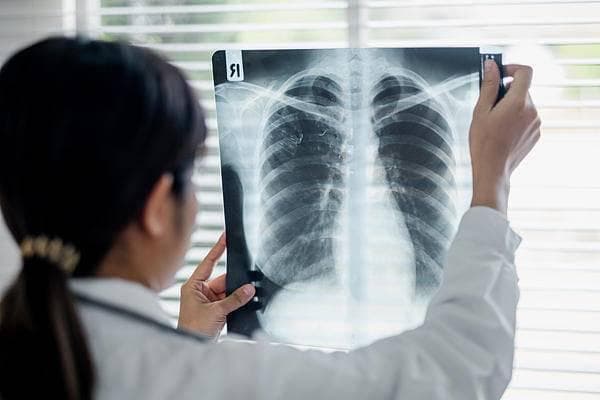 X光、CT、核磁共振，有何不同？“拍片”的辐射到底有多大？