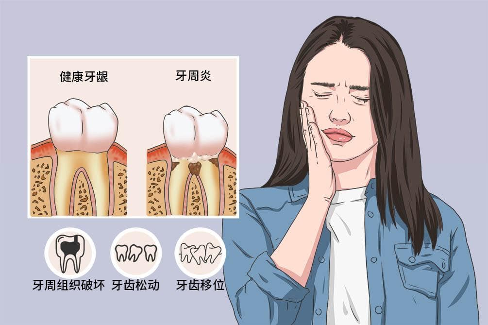 侵袭性牙周炎