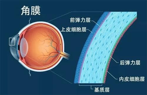 角膜塑形镜停戴后会反弹吗？专家解析OK镜使用后的视力变化
