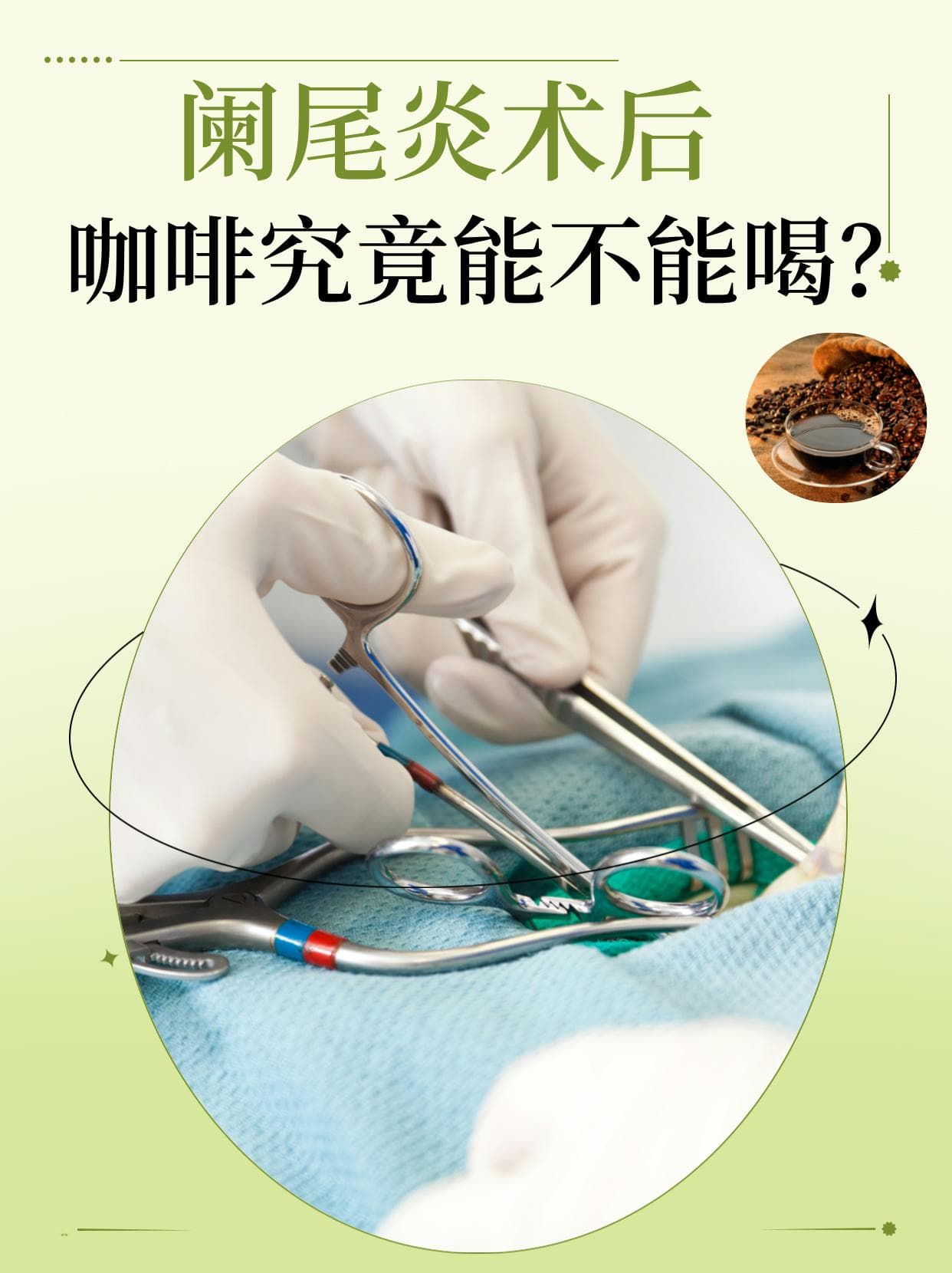 阑尾炎术后饮食全攻略：咖啡饮用指南及注意事项