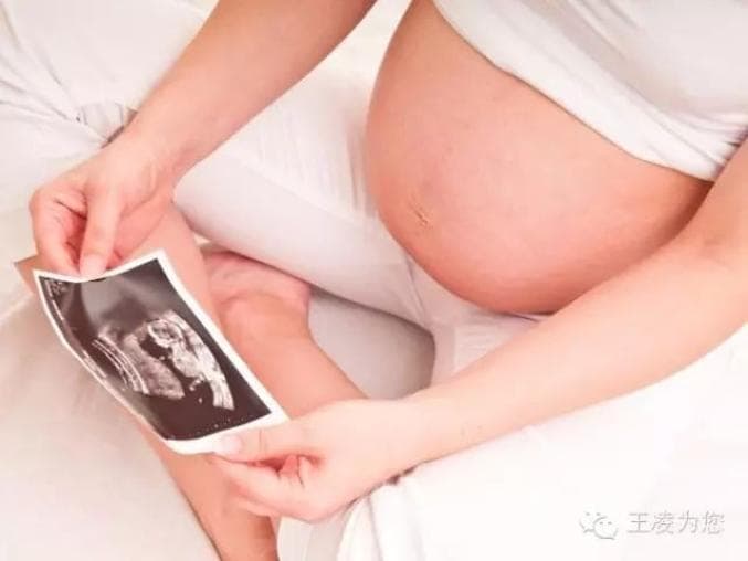 孕期B超检查全攻略：从NT到大畸形筛查