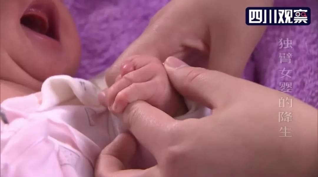 产检正常却生下独臂婴儿，涉事医院：检查漏肢，愿赔21万