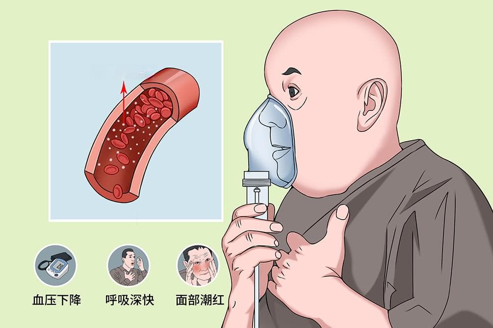 高碳酸血症
